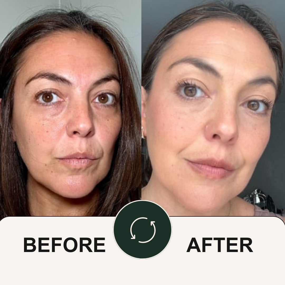Avocado Collagen Eye Mask
